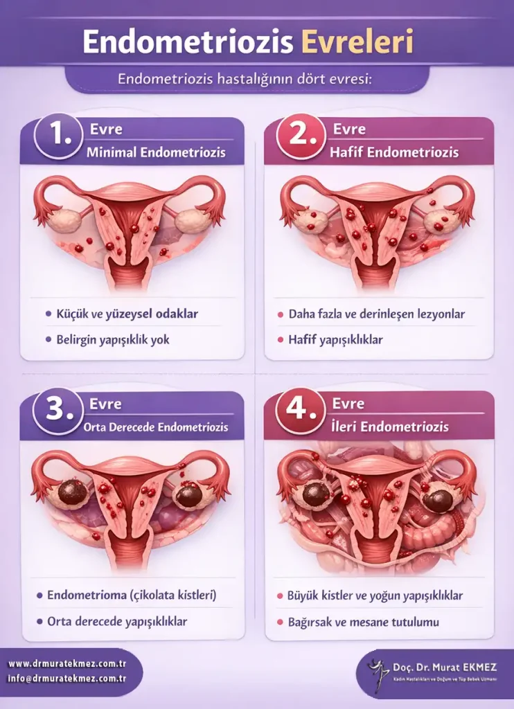 Endometriozis Evreleri