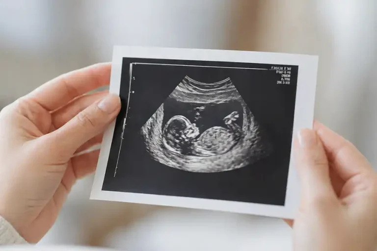 Gebelikte İkinci Düzey Ultrasonografi