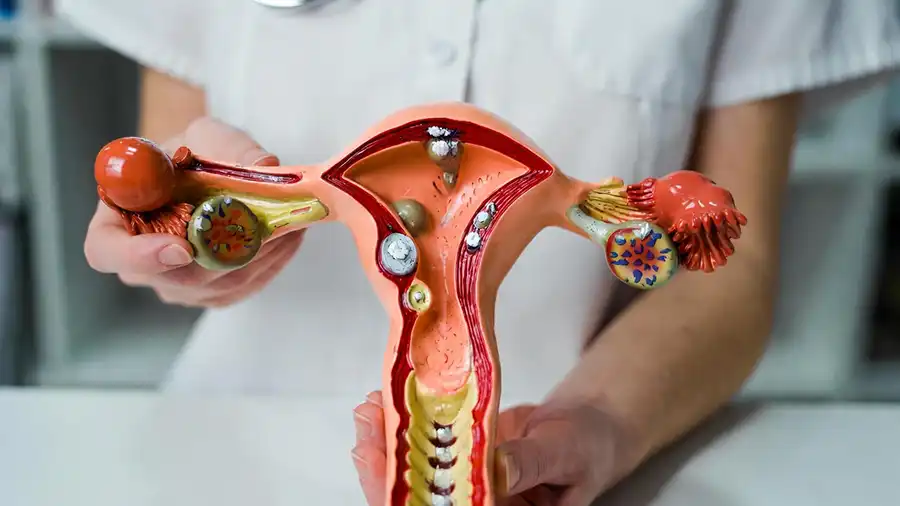 Açık Yumurtalık Kisti Ameliyatı (Kistektomi)