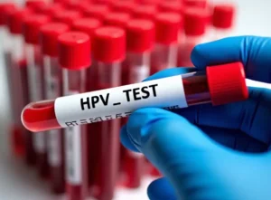 HPV Testi Nedir, HPV Testi Nasıl Yapılır? HPV Belirtileri