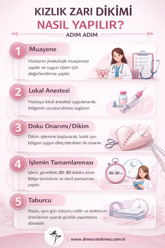 Kızlık Zarı Dikimi Nasıl Yapılır? (Himenoplasti)