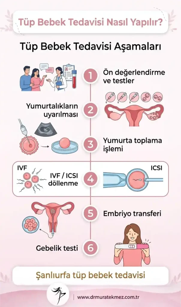 Şanlıurfa Tüp Bebek Nasıl Yapılır?